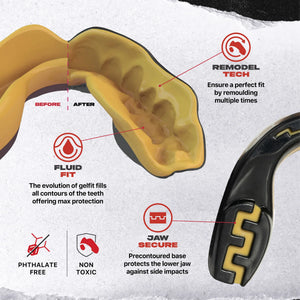 Proteza Dentara SAFEJAWZ Extro Series Self-Fit Goldie - Adulti